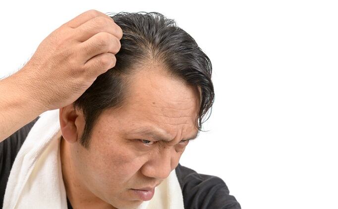 Plant-derived-phytochemicals-show-promise-as-hair-loss-treatment-says-International-Journal-of-Cosmetic-Science.jpg