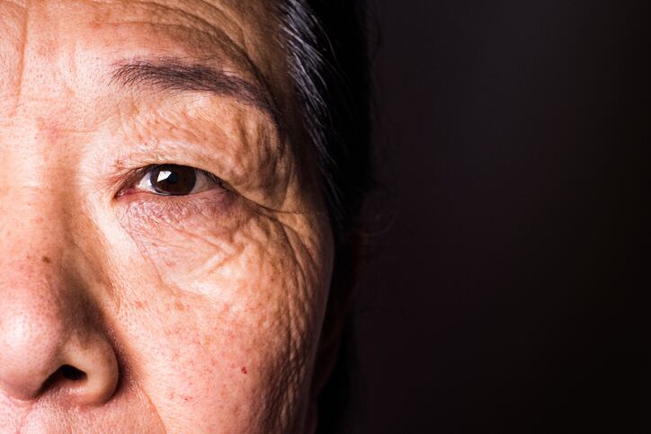 Shiseido fellow details ring collagen ‘discovery’ as promising for anti-ageing skin care