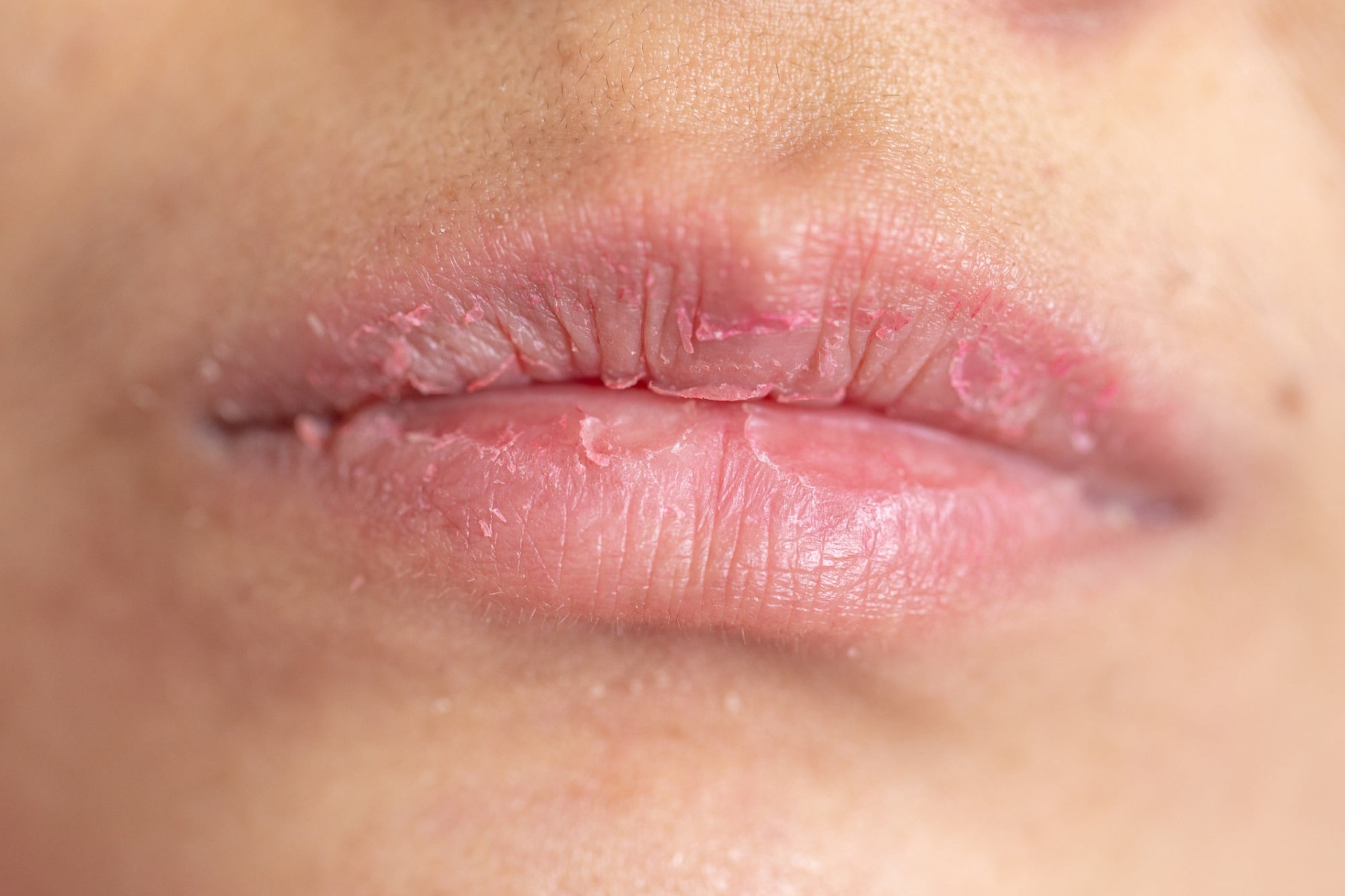 Suave-Brands-Company-successfully-completes-acquisition-of-1-lip-care-brand-ChapStick.jpg