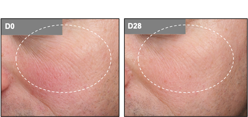 Figure4-Circalys.png