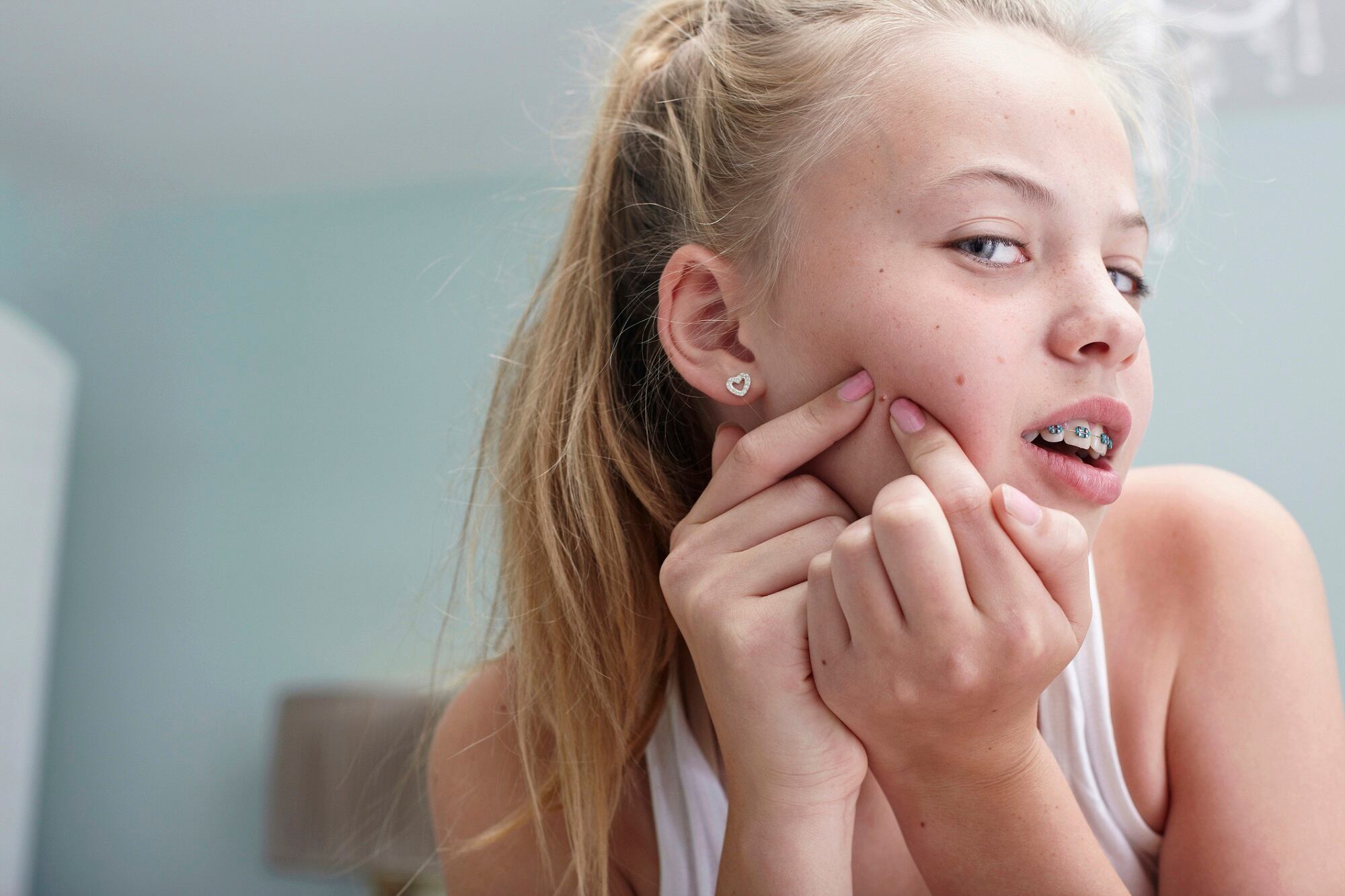 Q&A: ZitSticka Brand Director’s insights into navigating teen skin care in 2024