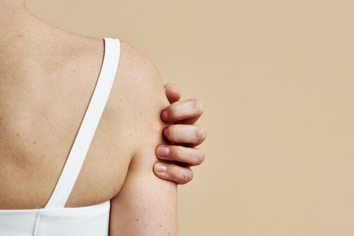 Probiotical study links synbiotic with improvements in skin conditions