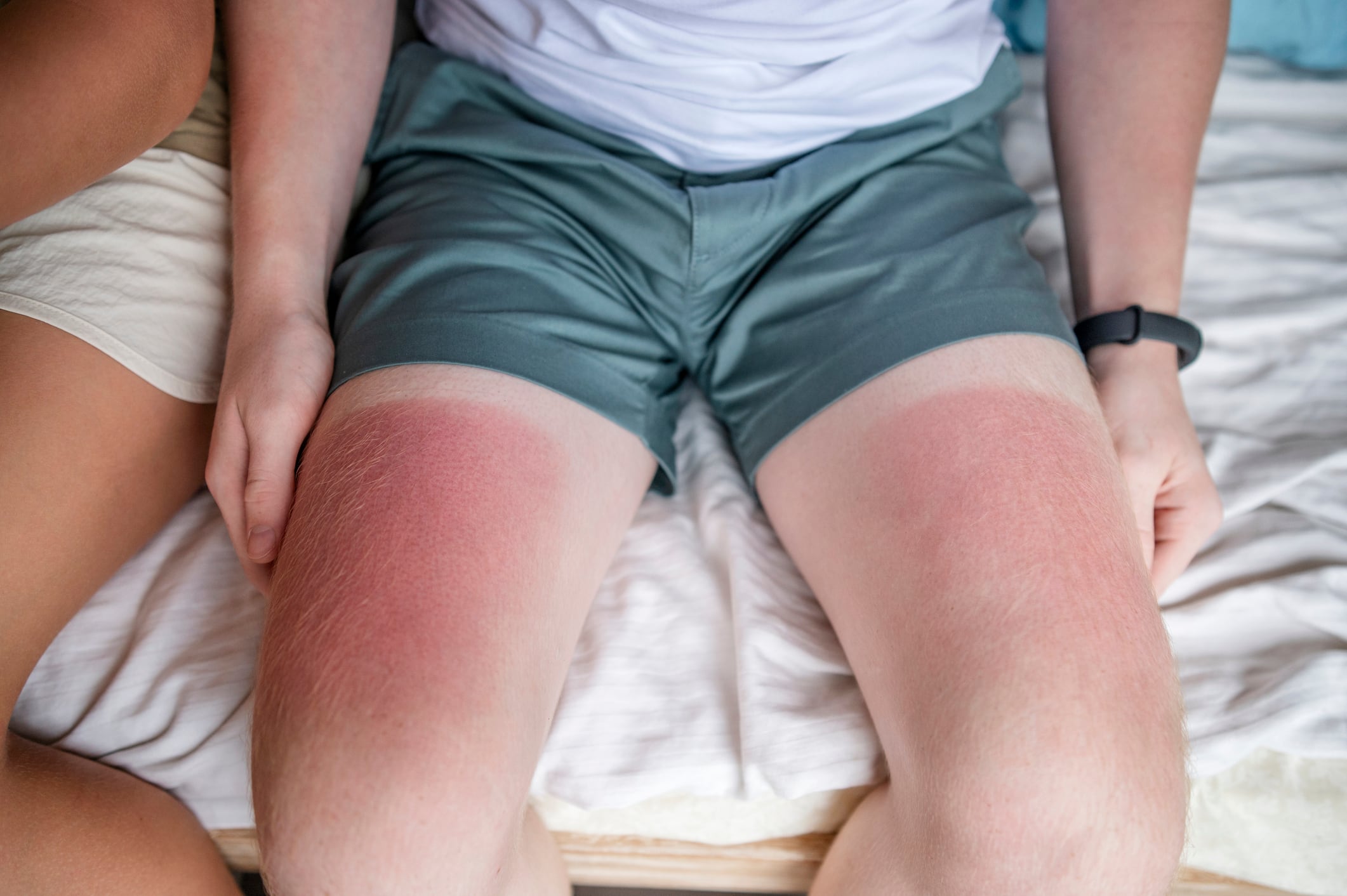 EWG's 19th annual Guide to Sunscreens spurs industry pushback on safety  claims, image size:2122x1412