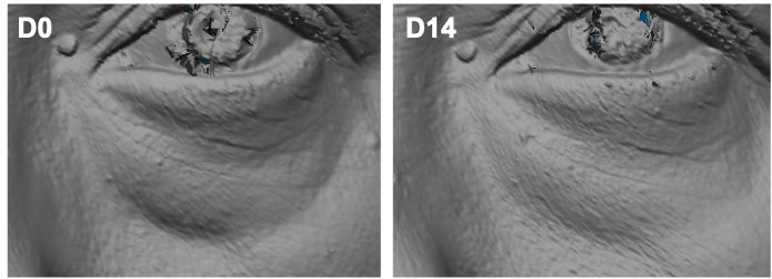 Figure2-Myralys-LowerEyeContour.png