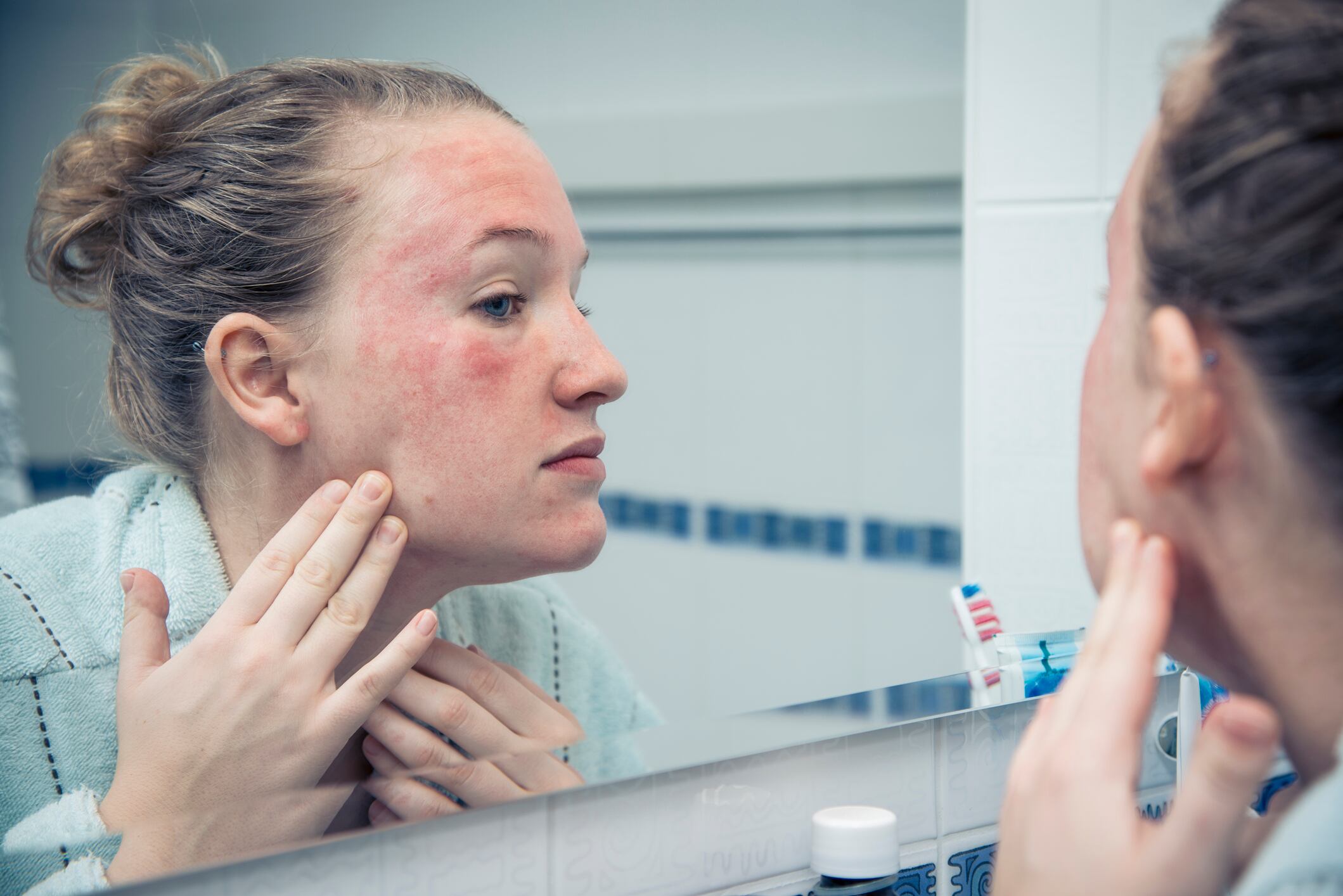 Research hints at crucial link between the gut microbiome and adult dermatitis – Chinese study