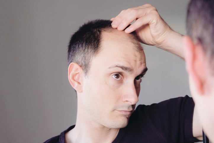 More fat means less hair, study suggests
