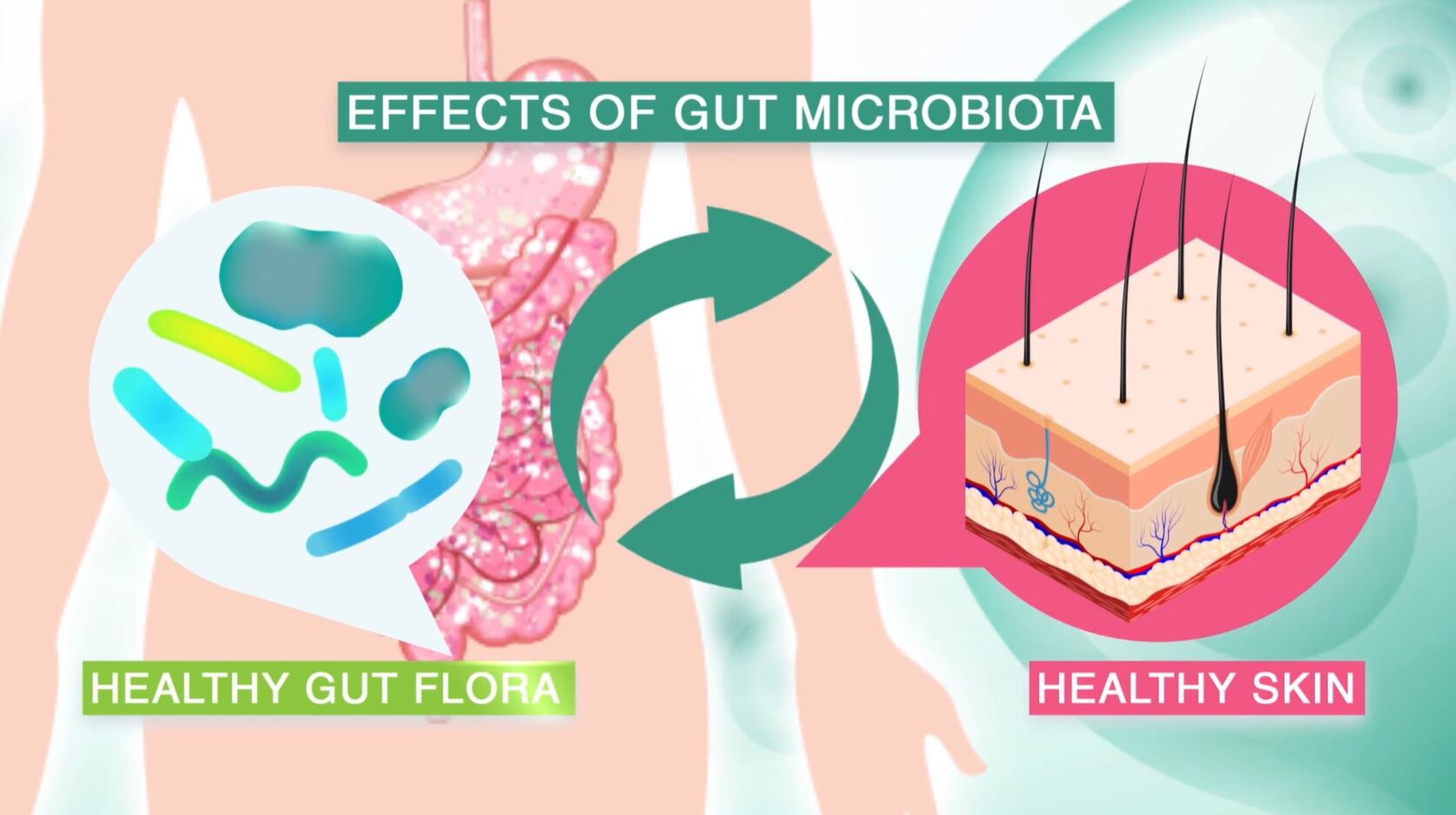 SkinBioTherapeutics launches probiotic supplement to target psoriasis