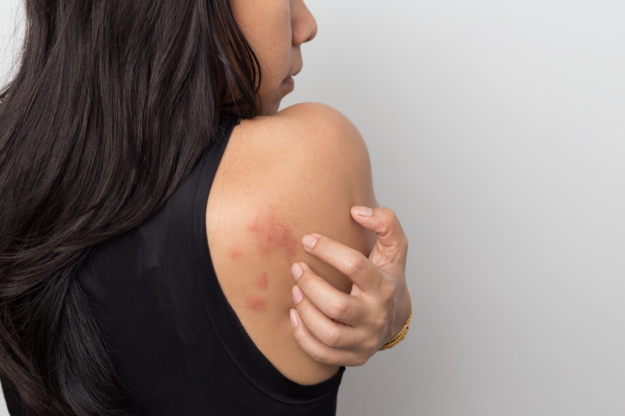 L’Oréal partners with WHO Foundation to “democratise access to skin health support”