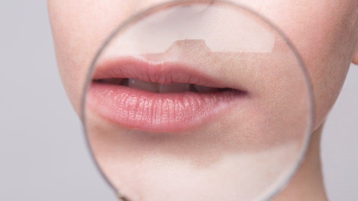 Not so allergenic? Sensitisation to former ‘Allergen of the Year’ found to be uncommon – Australia study