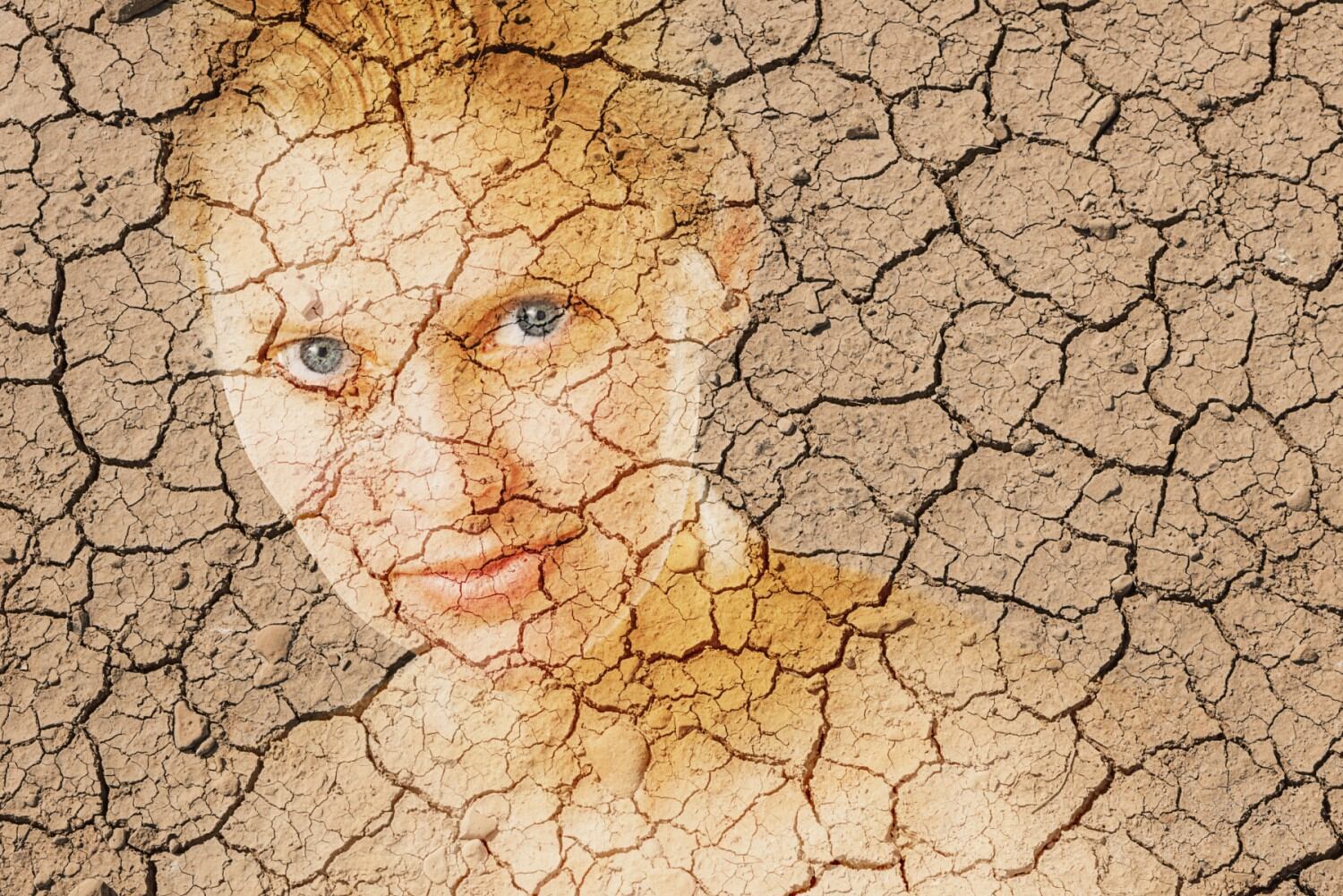 How climate change is impacting skin care NPD