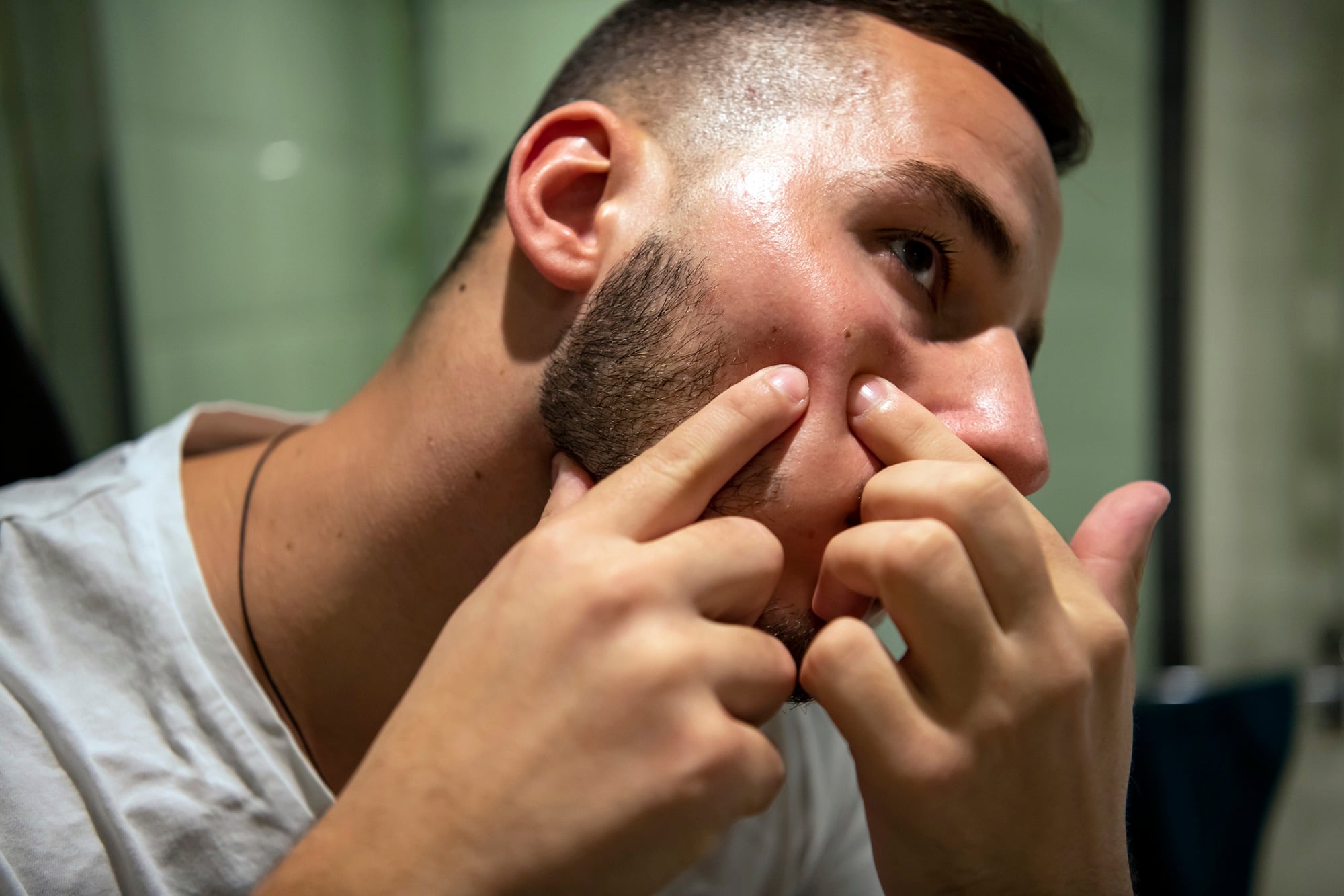 Nanoemulsion & combination of essential oils effective against acne, researchers determine