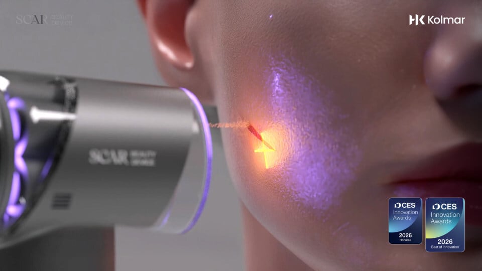 Kolmar Korea's Scar Beauty Device (in action)