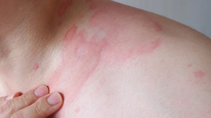 Testing expert discusses cosmetic labeling to avoid allergic reactions