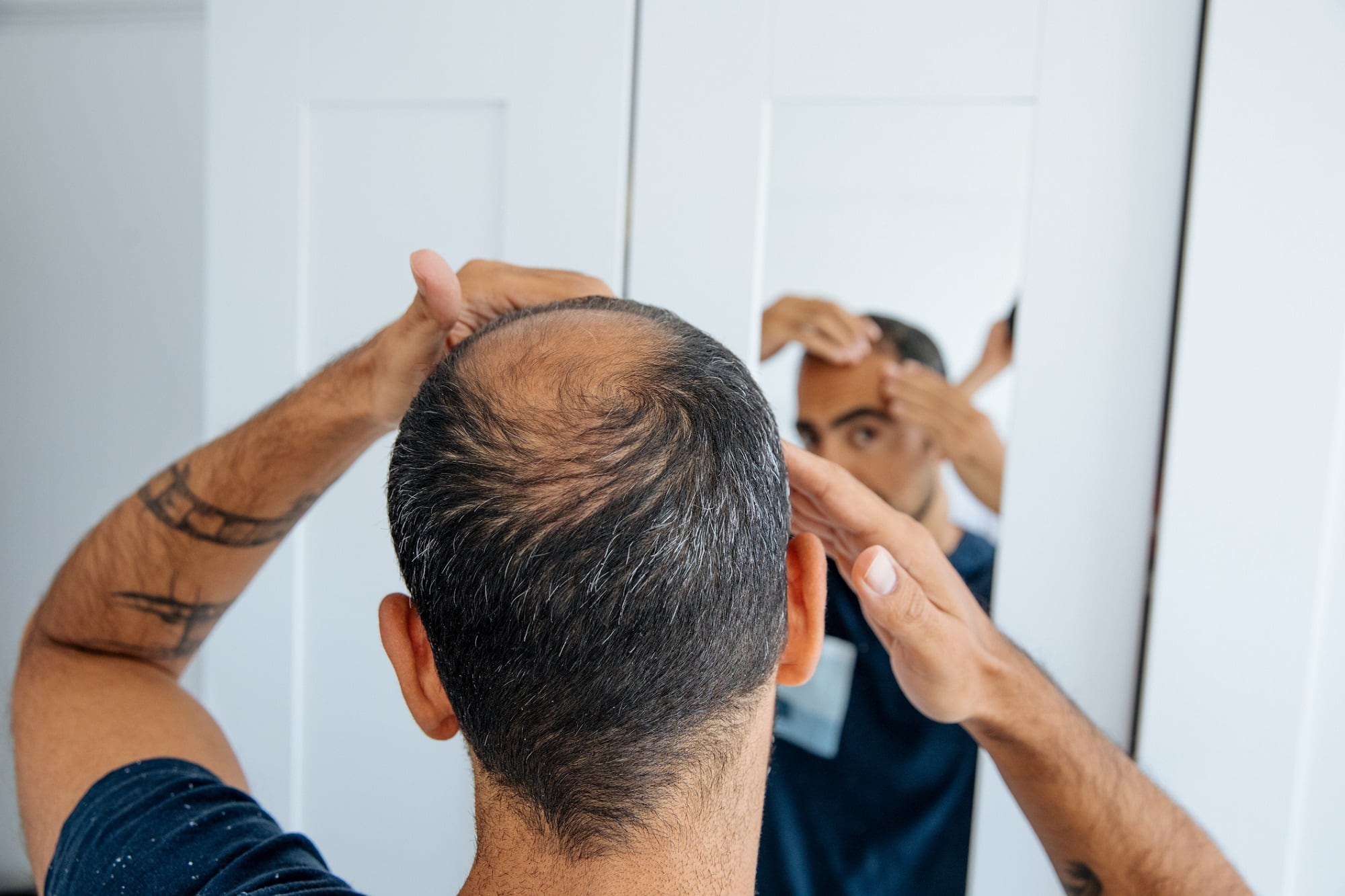 Great Many secures $3.6m pre-seed to advance hair growth solutions