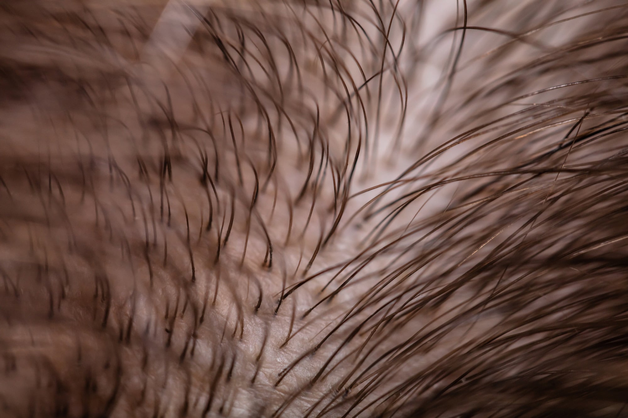 Nutrafol expands physician-exclusive MD Booster hair growth supplement line