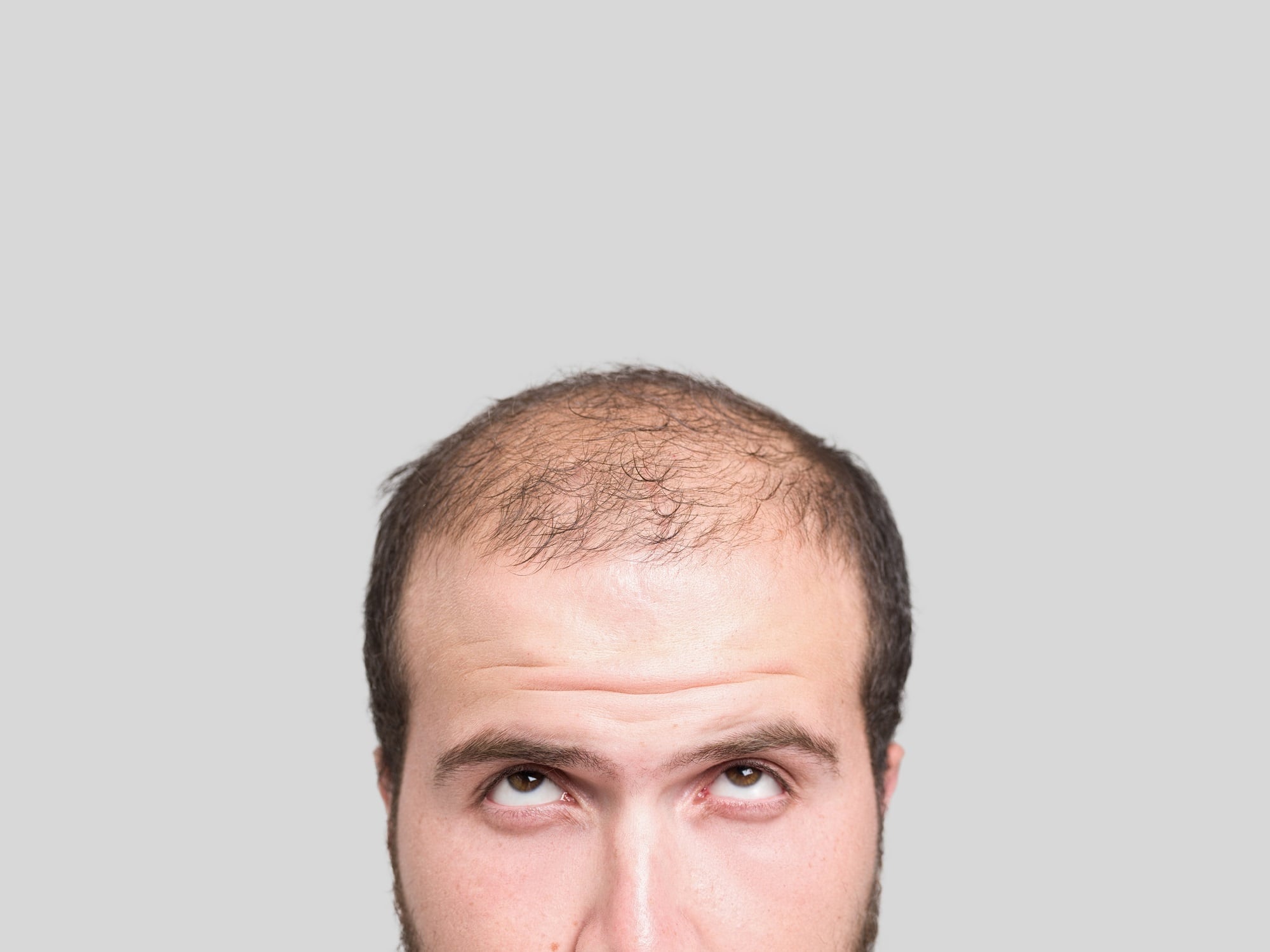 Rogaine's “National Hats Off Day” seeks to reframe discussions surrounding male hair loss 