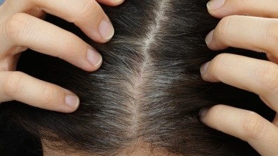 Scientists identify grey hair gene for first time