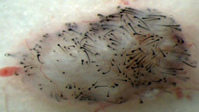 Scientists use stem cells to grow new hair