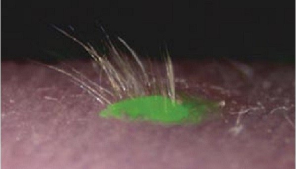 “Transplanted bioengineered skin created using mouse stem cells labeled to glow green.” (Photo by Takashi Tsuji, RIKEN Center for Developmental Biology)