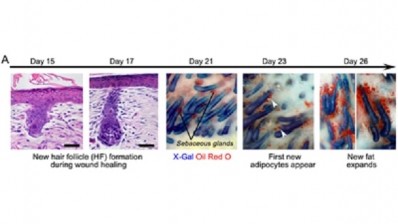 New research on the prevention of scars has anti-aging potential